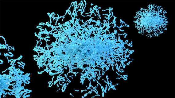 Neue Hinweise auf Langzeitwirkung von Prasinezumab bei Parkinson – weitere placebokontrollierte Studien erwartet