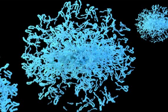 Neue Hinweise auf Langzeitwirkung von Prasinezumab bei Parkinson – weitere placebokontrollierte Studien erwartet