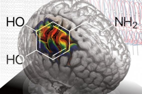 Hirnstimulation imitiert Dopamin-Effekt