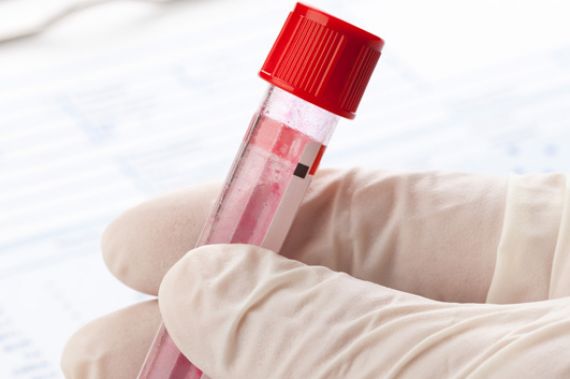 Erstmals Bluttest zur Parkinson-Früherkennung